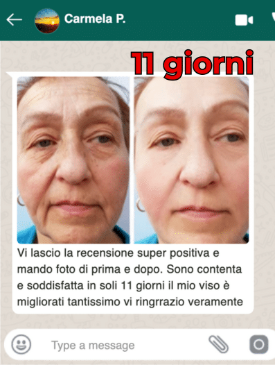RECENSIONI WP ANTIAGE
